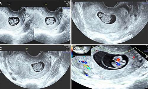 sonogram 源码